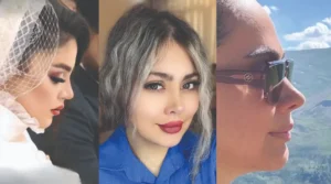 بهترین دکتر جراح عمل بینی در تهران