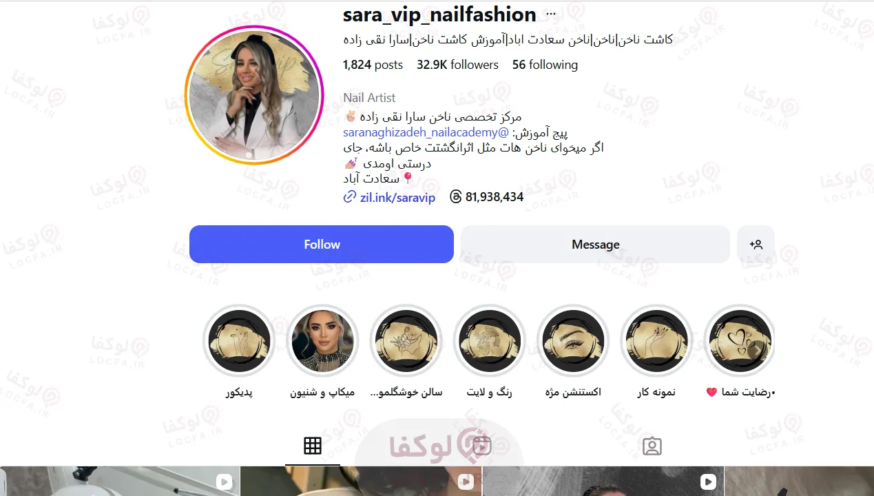 هزینه کاشت ناخن در تهران