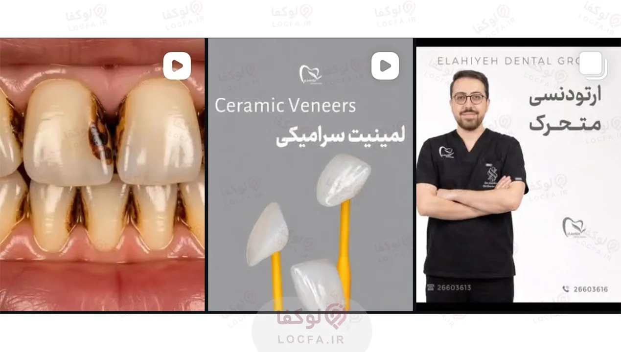 کلینیک دندانپزشکی الهیه | بهترین کلینیک دندانپزشکی تهران 8 بهترین کلینیک دندانپزشکی در الهیه - سایت لوکفا