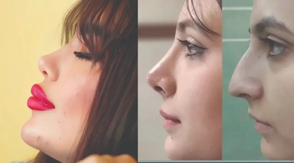 دکتر هادی سرمست - لوکفا