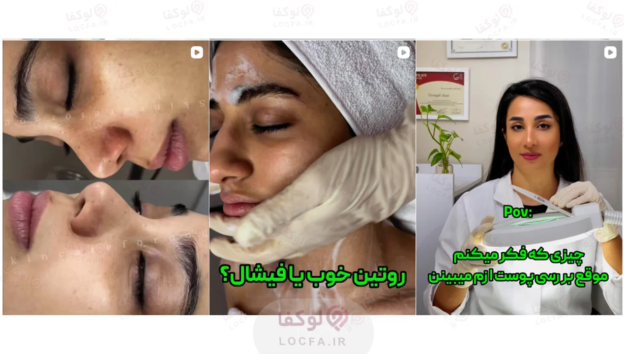 بهترین مرکز فیشیال غرب تهران | 11 مرکز پاکسازی پوست 38 کلینیک فیشال و خدمات پوست فروغ