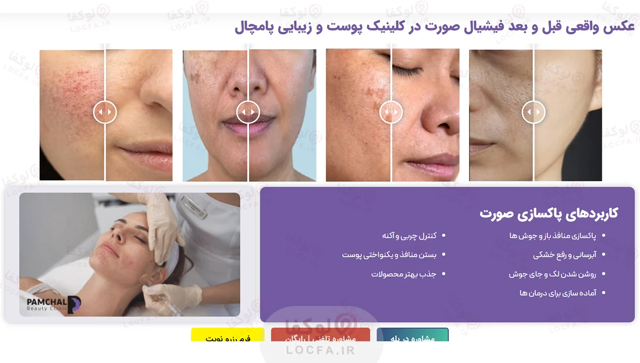 بهترین مرکز فیشیال غرب تهران | 11 مرکز پاکسازی پوست 27 فیشیال در سعادت آباد - لوکفا
