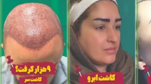 کلینیک زیبایی و کاشت مو الهام