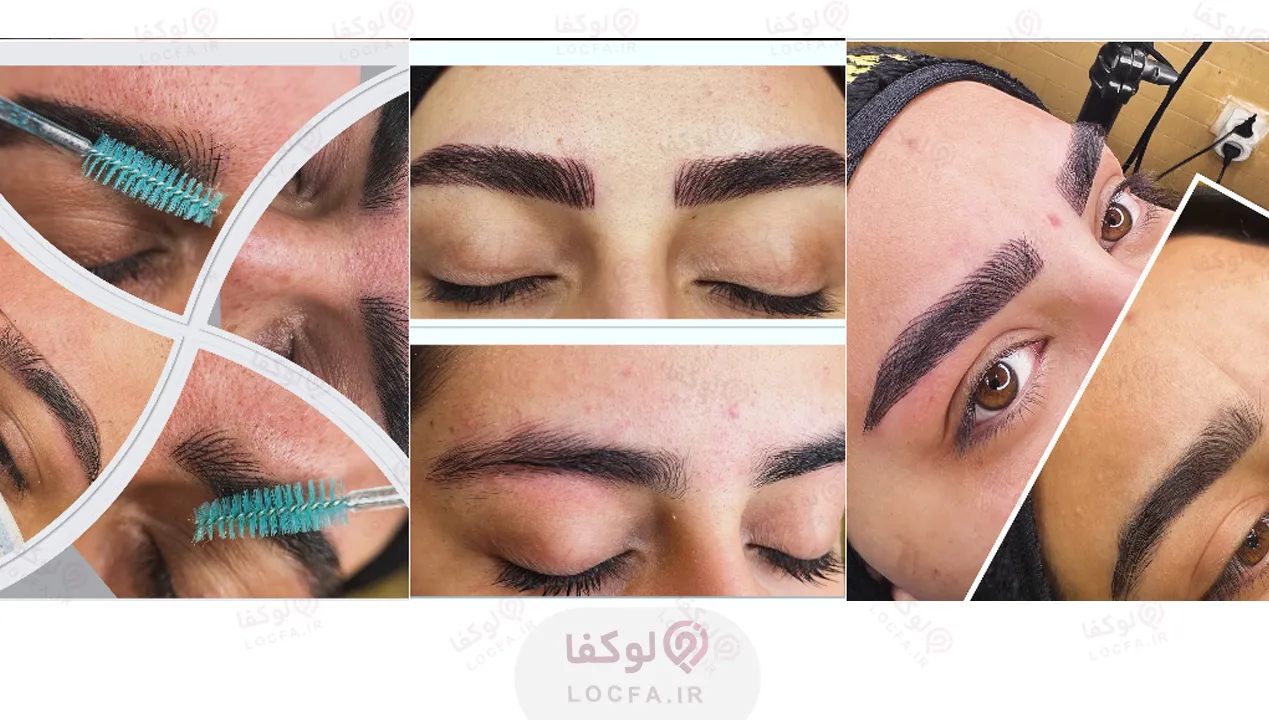 سالن فیبروز ابرو