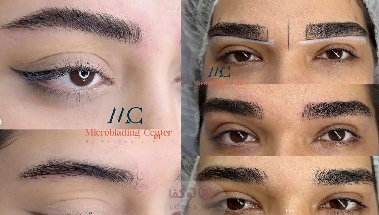 بهترین میکروبلیدینگ در اصفهان